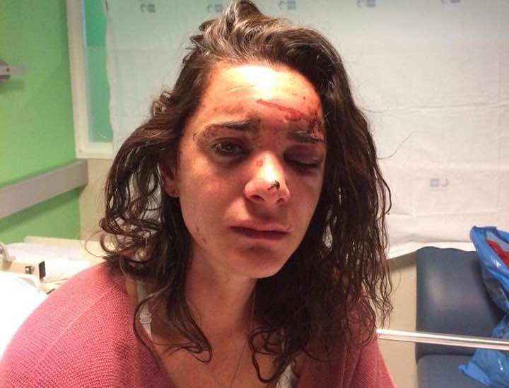 Tæmme Ydmyghed røgelse Rape and brutal beating in Madrid - Jupsin Andrea Sigcinano