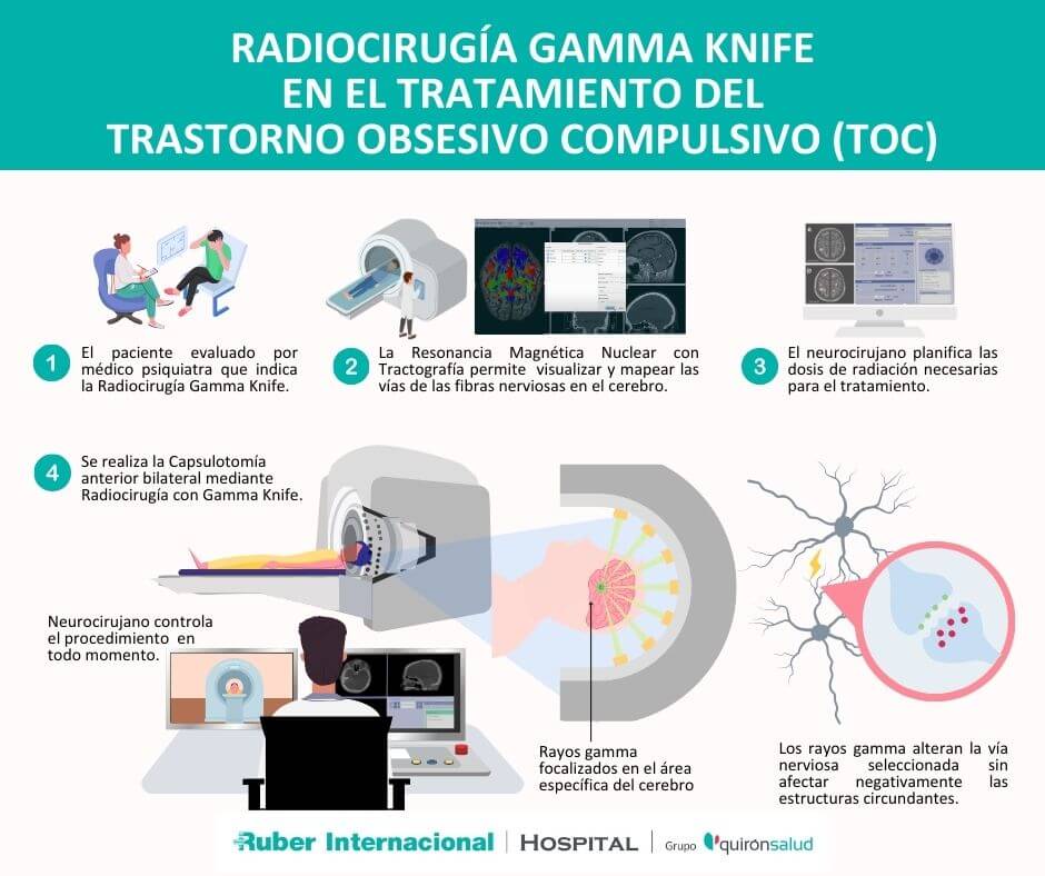 TOC y tratamiento mediante radiocirugía con Gamma Knife